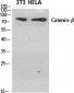 Catenin-β Polyclonal Antibody